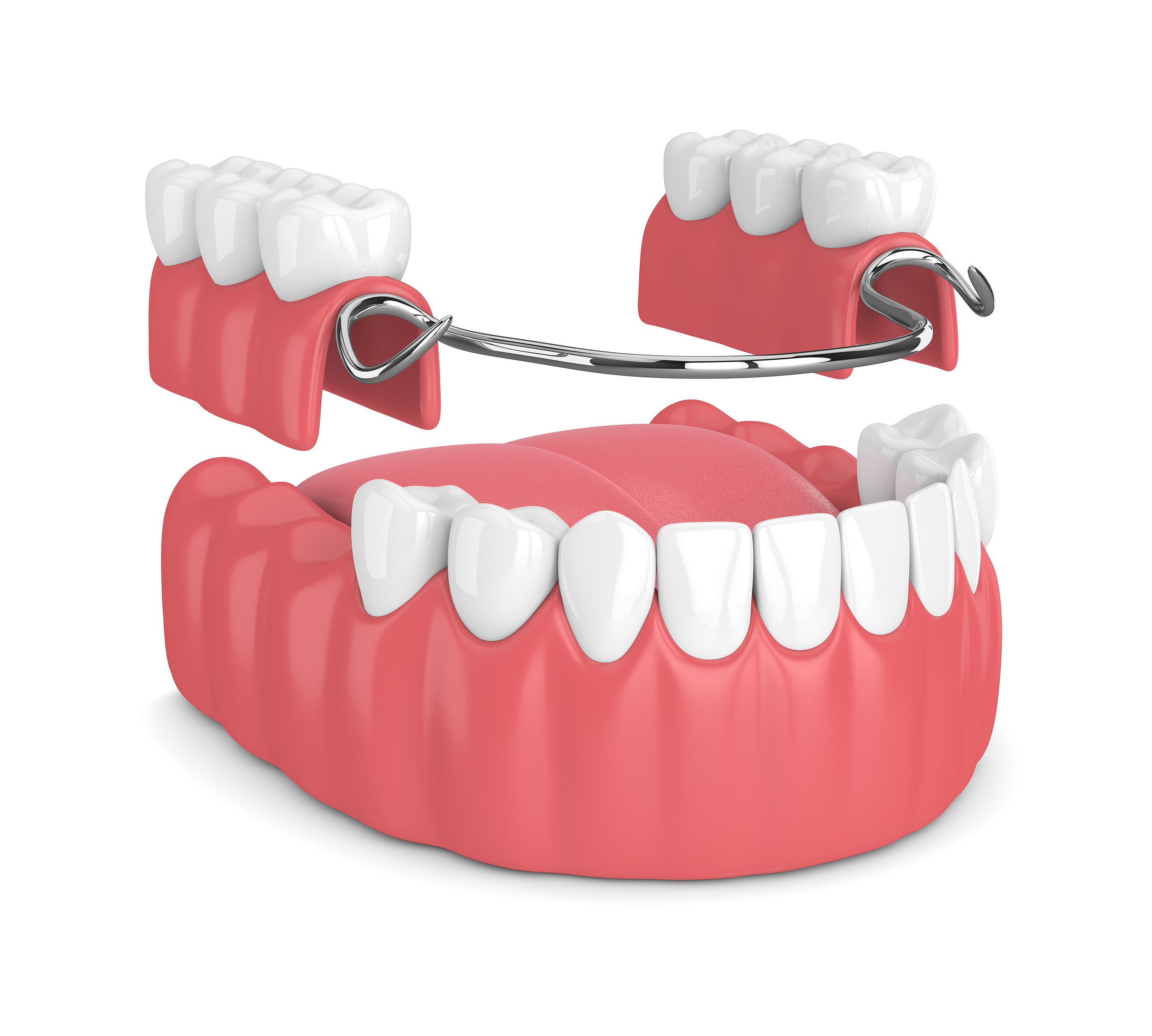 Partial Dentures Partial Dentures